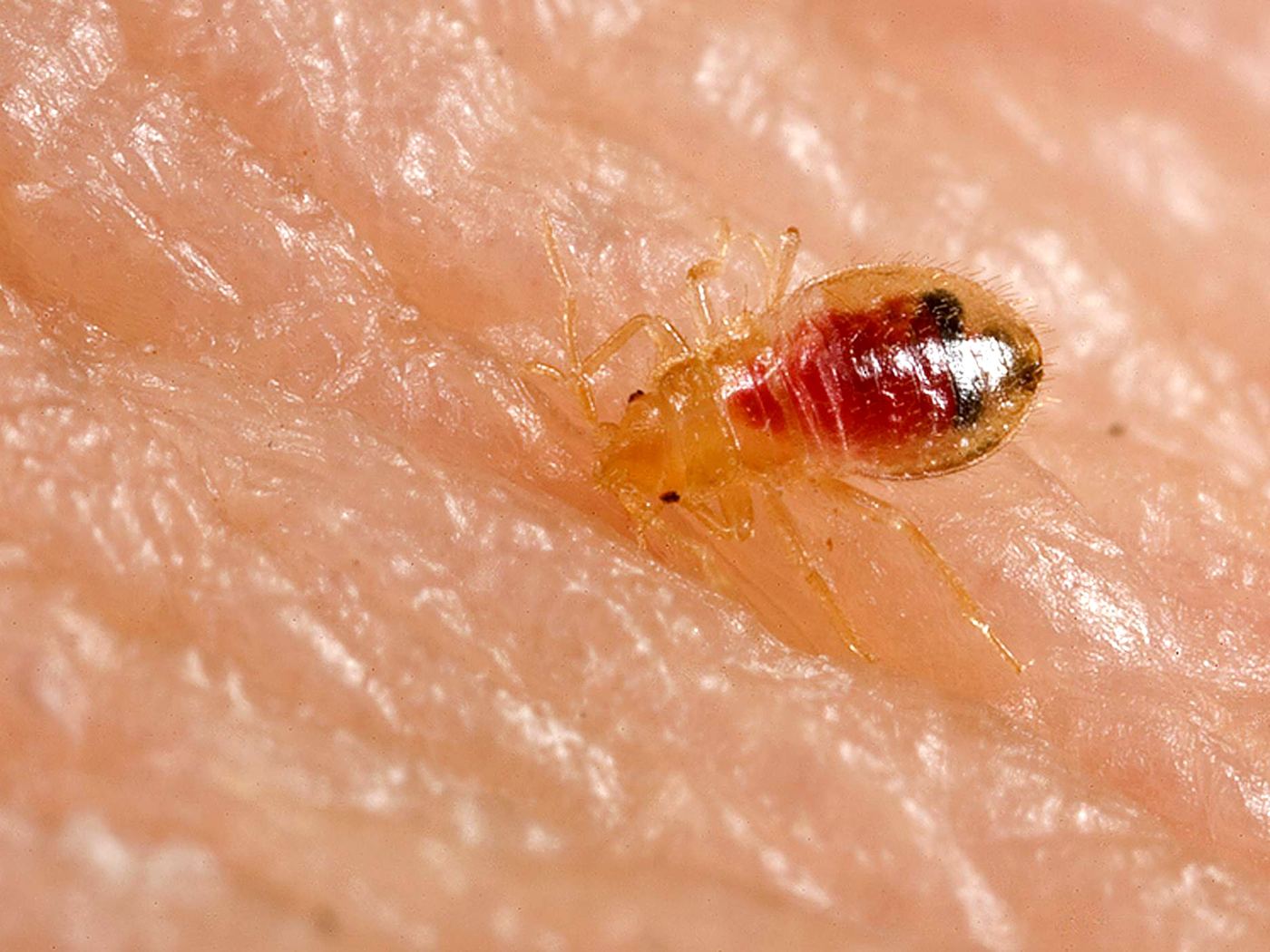 Educational close-up of a bedbug nymph on a voluntary human host