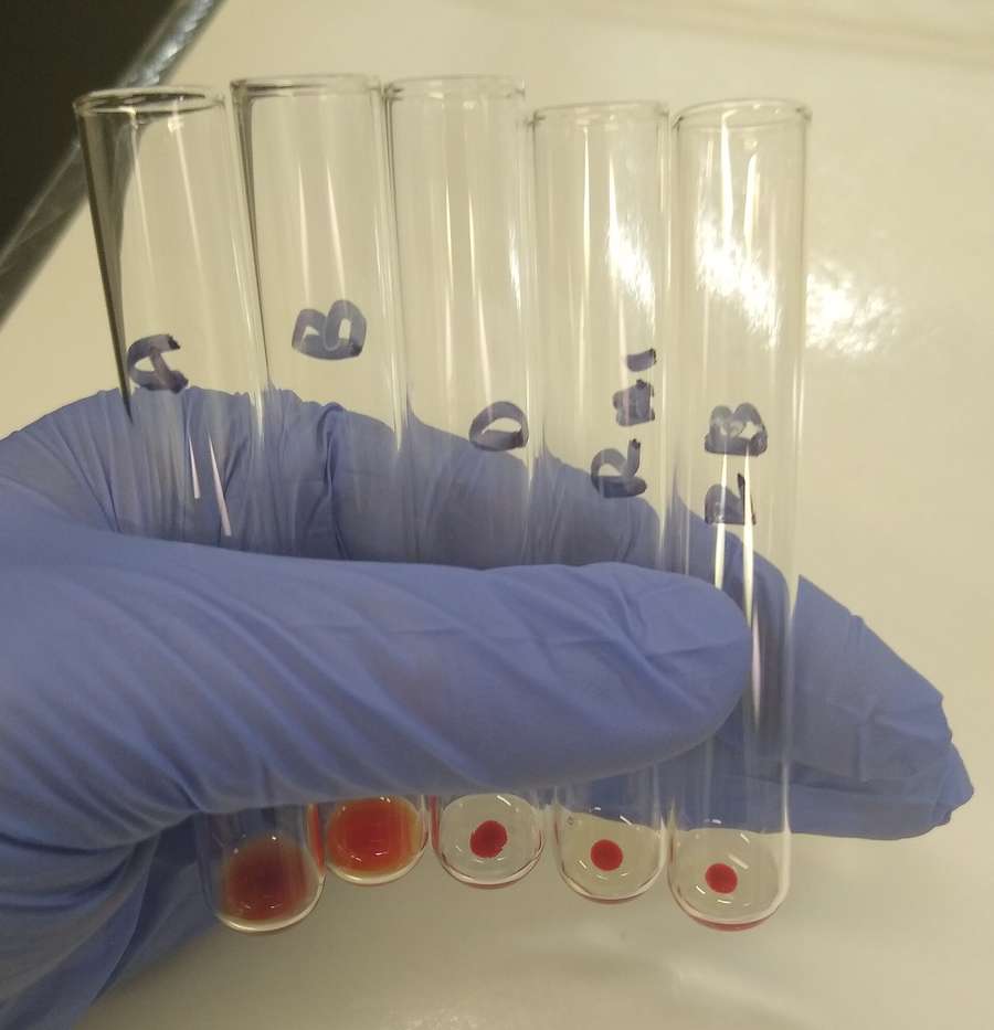 A gloved hand holding labeled sample tubes - testing in Poland is free and anonymous at PKD points