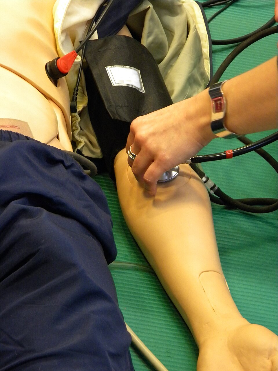 Blood pressure measurement - routine checks are where private packages earn their monthly fee
